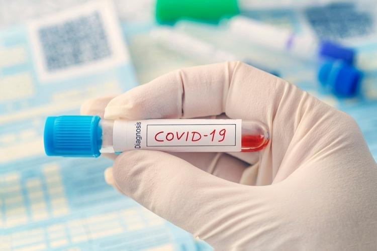 teste coronavirus