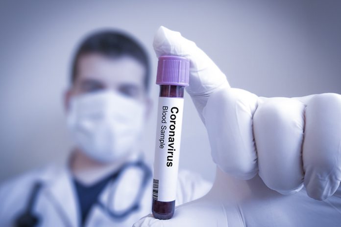 coronavirus-covid-19 coronavirus-covid-19
